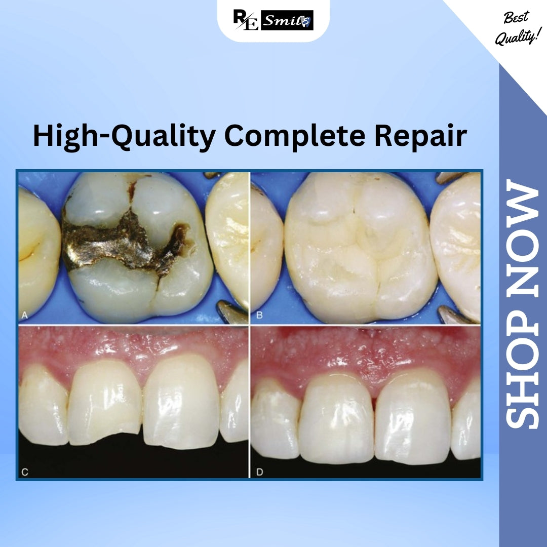 Dental Bonding Agent