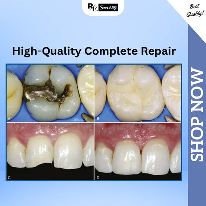 Dental Bonding Agent